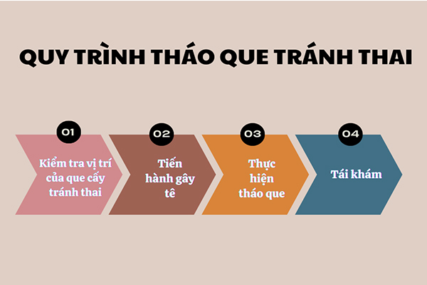 Quy trình thực hiện tháo que tránh thai chuẩn khoa học tại Hải Dương