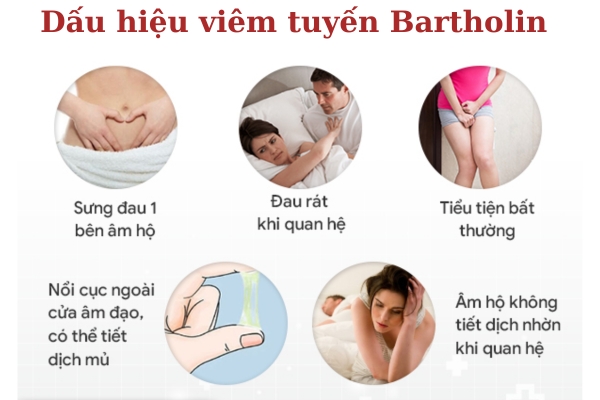Viem-tuyen-bartholin (4)