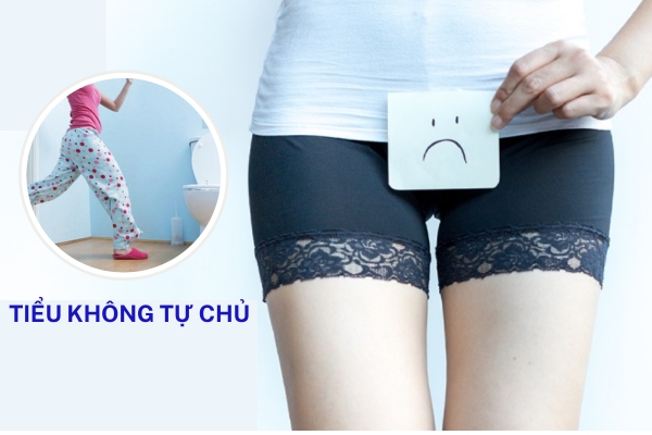 Tiểu không kiểm soát ở nữ là bị bệnh gì?