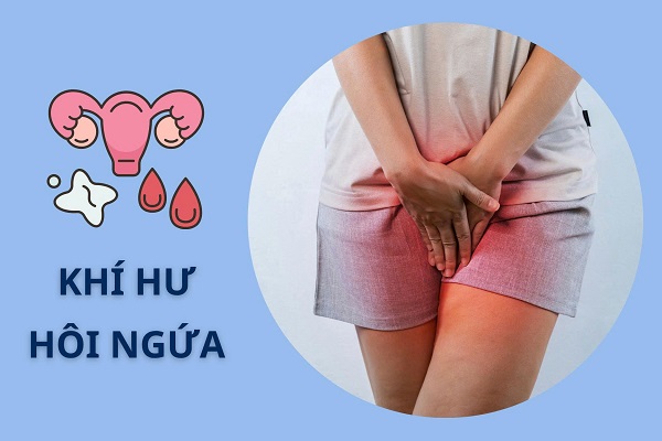 Khí hư có mùi hôi và ngứa – dấu hiệu bệnh gì?
