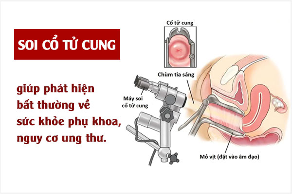 Soi-co-tu-cung-1