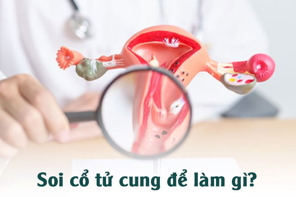 Soi cổ tử cung là gì và khi nào nên thực hiện?