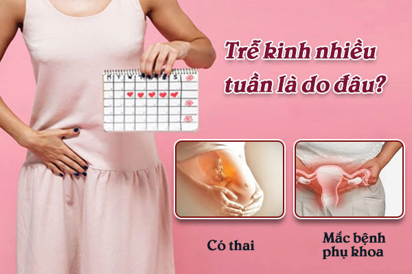 Trễ kinh nhiều tuần là do đâu?