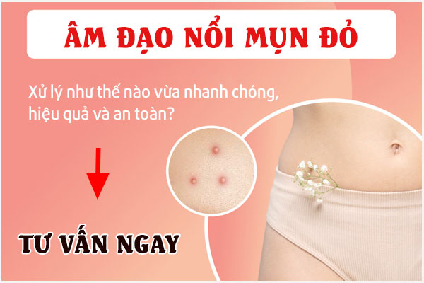 Am-dao-noi-mun-do