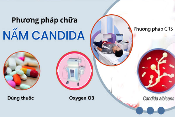 Chua-nam-candida