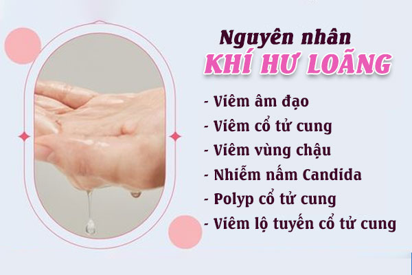 Khi-hu-loang