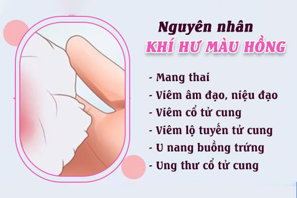 Khi-hu-mau-hong-1