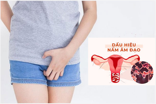 Cách điều trị nấm phụ khoa hiệu quả và an toàn