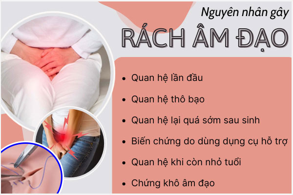 Nguyen-nhan-rach-am-dao