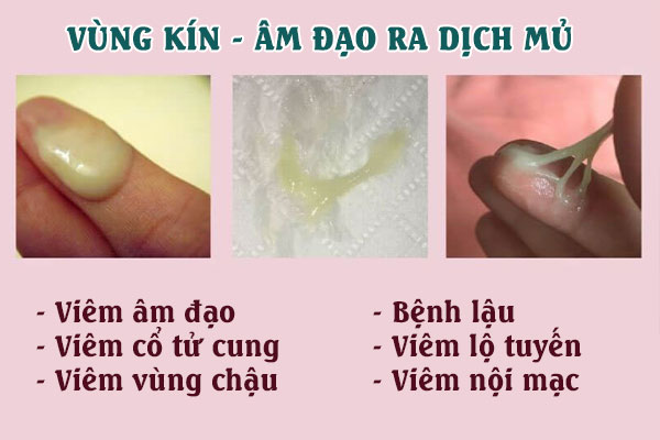 Ra-dich-mu-1