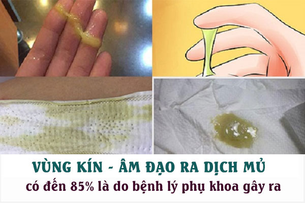 Ra-dich-mu