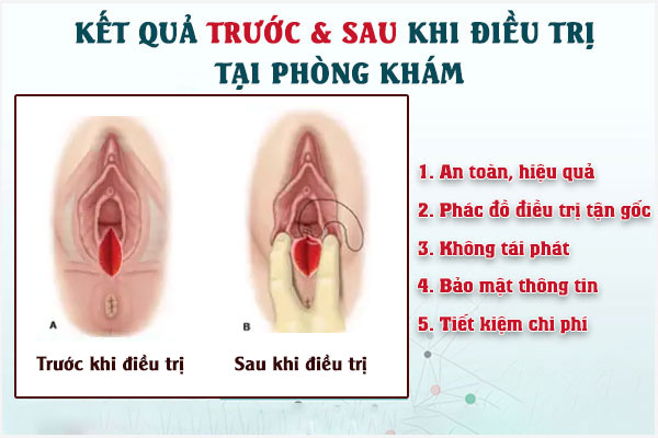 Rach-da-vung-kin-2