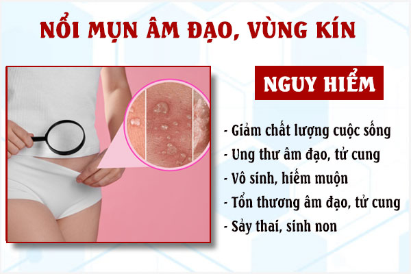 Tac-hai-mun-am-dao