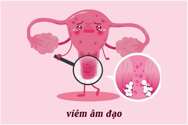Viem-am-dao