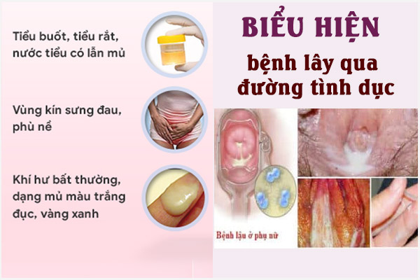 Khi-hu-vang-xanh-2