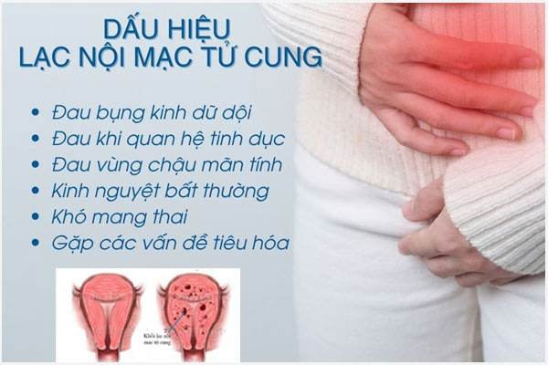 Lac-noi-mac-tu-cung