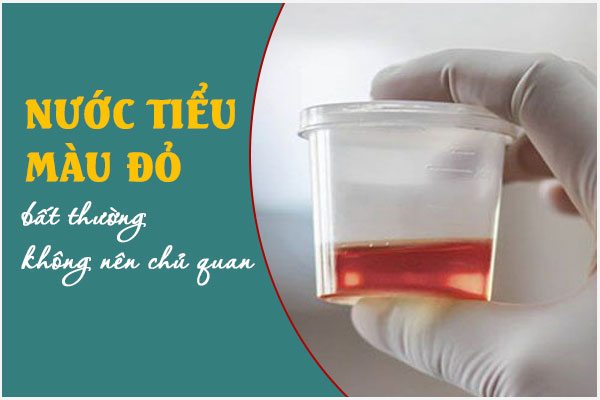 Tiểu ra nước tiểu màu đỏ là bị gì? Có nguy hiểm không?
