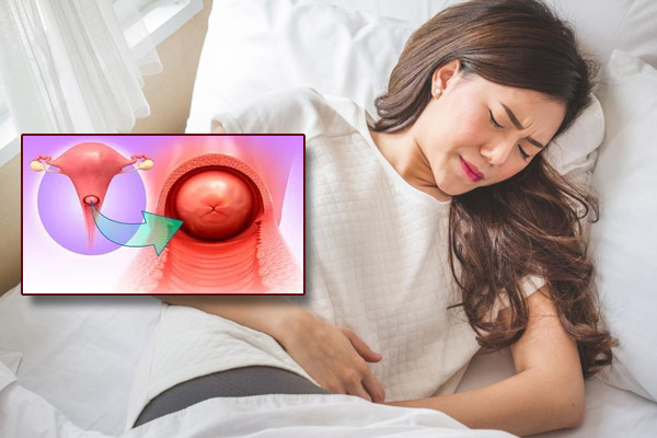 Phì đại cổ tử cung bệnh lý phụ khoa nguy hiểm đừng nên chủ quan!
