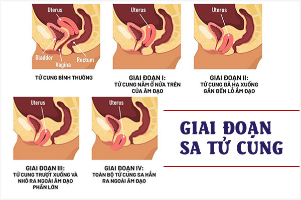 Sa-tu-cung-1