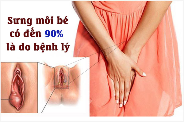 Bị sưng môi bé là bị gì? Có nguy hiểm không? Cách khắc phục hiệu quả?