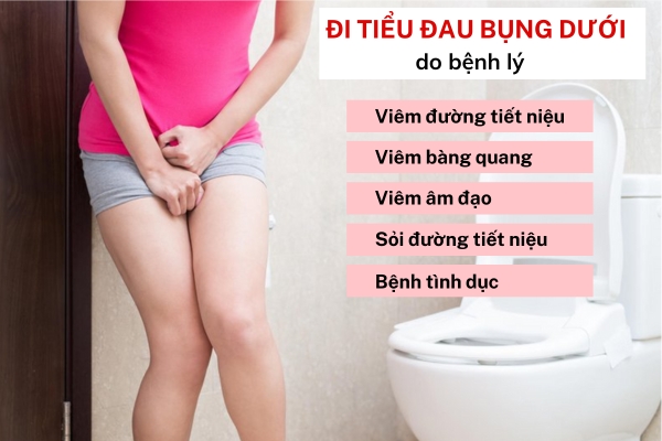 Nguyên nhân đi tiểu bị đau bụng dưới và Cách khắc phục hiệu quả