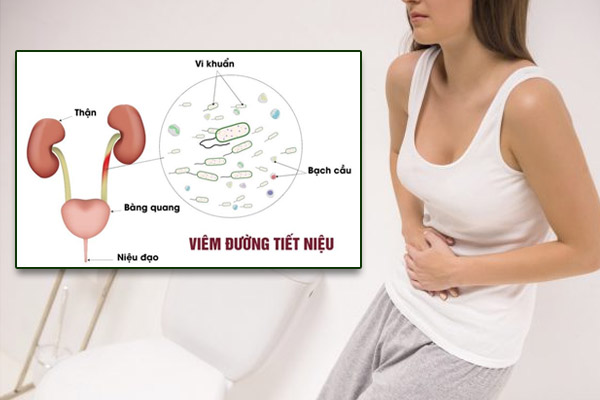 Cách điều trị viêm đường tiết niệu ở nữ
