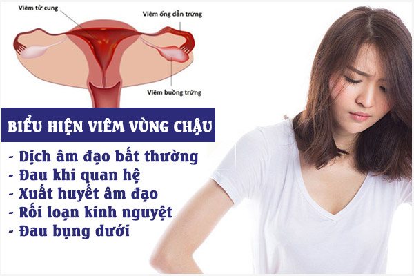 Viem-vung-chau